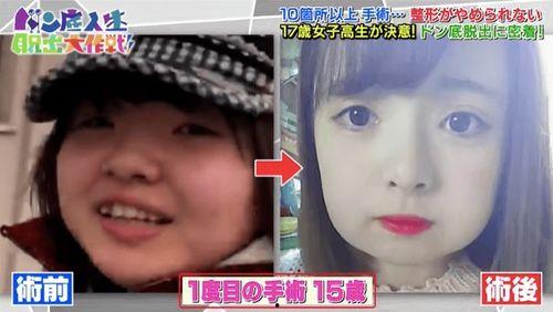 日本整形经历,探索美丽与自信的蜕变之旅
