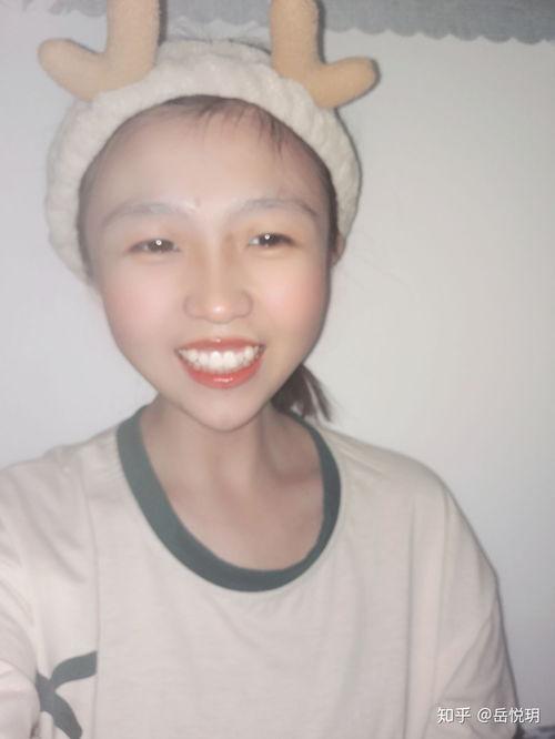 人长兔牙图片大全,人长兔牙图片大全揭秘