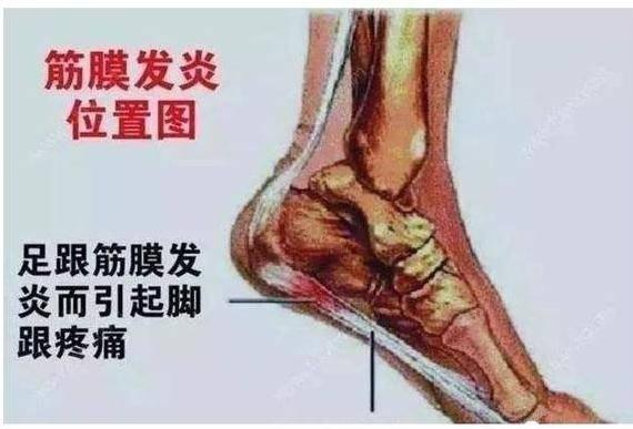脚后跟发白图片,探寻健康与美丽之道