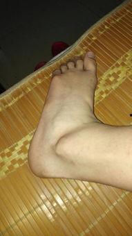 脚后跟发白图片,探寻健康与美丽之道