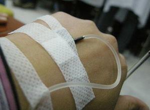 手部打针图片大全,真实记录针尖下的温馨与勇敢