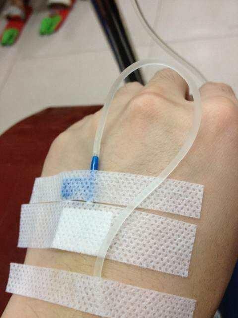 手部打针图片大全,真实记录针尖下的温馨与勇敢