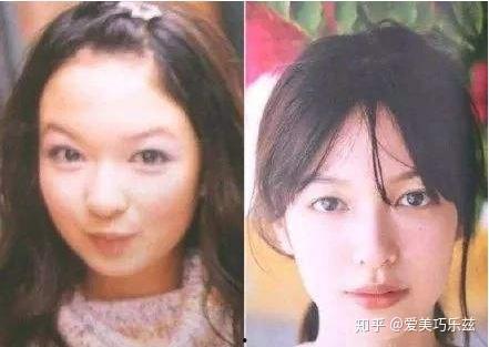 日本人整容,揭秘整容文化背后的社会现象