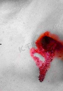 伤口的图片,图解伤口愈合全貌